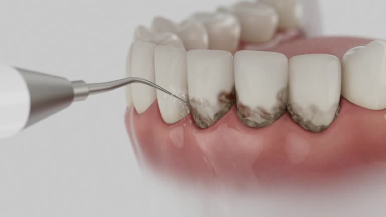 Trusted Tooth Extraction service in Billings, MT - Dentist Open Now